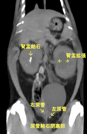 CT検査所見